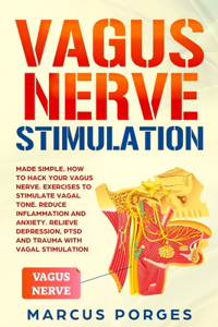 Vagus Nerve Stimulation