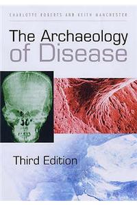 The Archaeology of Disease
