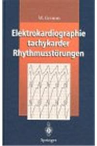 Elektrokardiographie Tachykarder Rhythmusstarungen