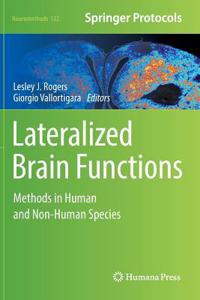 Lateralized Brain Functions