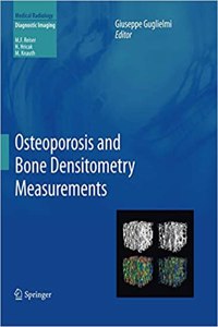 Osteoporosis and Bone Densitometry Measurements