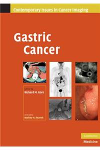 Gastric Cancer