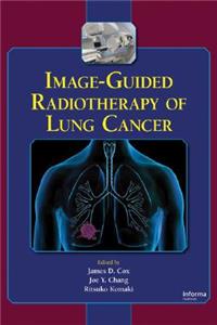 Image-Guided Radiotherapy of Lung Cancer