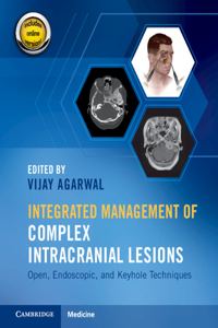 Integrated Management of Complex Intracranial Lesions Hardback Set and Static Online Product