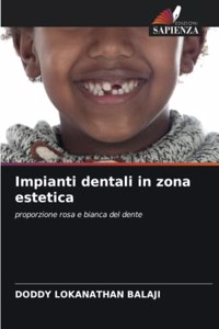 Impianti dentali in zona estetica