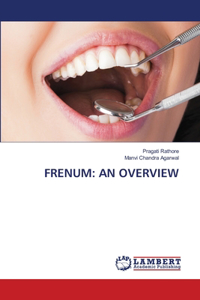 Frenum