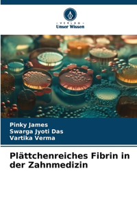 Plättchenreiches Fibrin in der Zahnmedizin