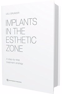 Implants in the Esthetic Zone