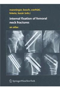 Internal Fixation of Femoral Neck Fractures: An Atlas