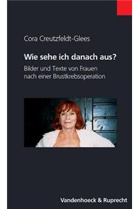 Wie Sehe Ich Danach Aus?