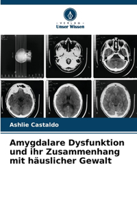 Amygdalare Dysfunktion und ihr Zusammenhang mit häuslicher Gewalt