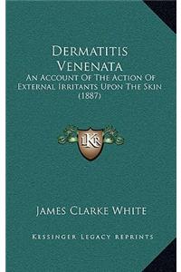 Dermatitis Venenata