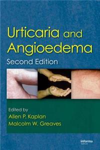 Urticaria and Angioedema