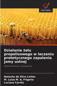 Dzialanie żelu propolisowego w leczeniu protetycznego zapalenia jamy ustnej