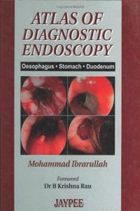 Atlas (Rp) Of Diagnostic Endoscopy,