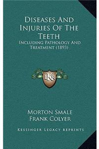 Diseases And Injuries Of The Teeth