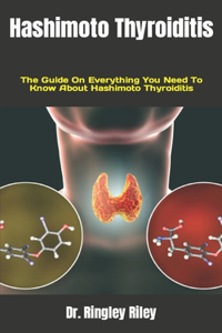 Hashimoto Thyroiditis