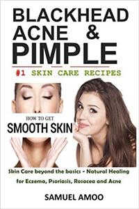 Blackheads, Acne & Pimple: Blackheads, Acne, Pimple Home Remedies & Treatment Book