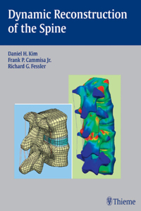 Dynamic Reconstruction of the Spine: