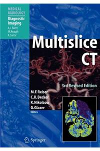 Multislice CT