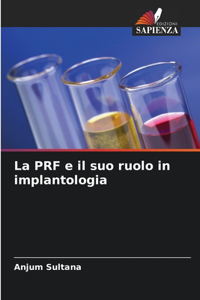 PRF e il suo ruolo in implantologia