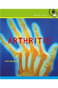 Arthritis