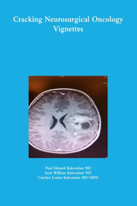 Cracking Neurosurgical Oncology Vignettes