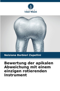 Bewertung der apikalen Abweichung mit einem einzigen rotierenden Instrument