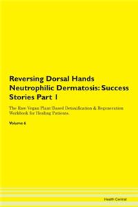 Reversing Dorsal Hands Neutrophilic Derm