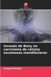 Invasão de Bony no carcinoma de células escamosas mandibulares