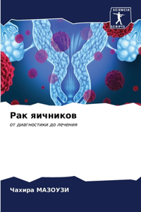 Рак яичников