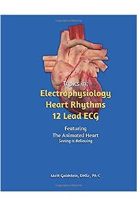 Topics in: Electrophysiology, Heart Rhythms, 12 Lead ECG