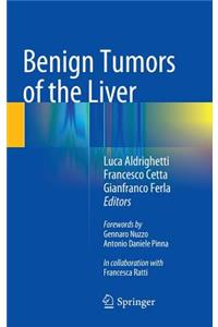 Benign Tumors of the Liver