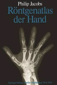 Rontgenatlas der Hand