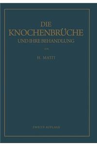 Die Knochenbrüche und ihre Behandlung