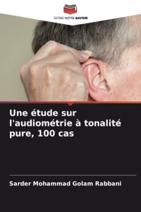étude sur l'audiométrie à tonalité pure, 100 cas