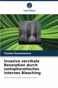 Invasive zervikale Resorption durch iontophoretisches internes Bleaching