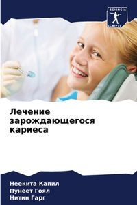 Лечение зарождающегося кариеса