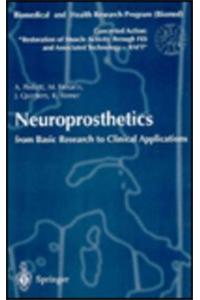 Neuroprosthetics