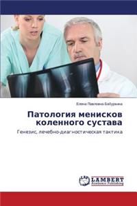 Patologiya Meniskov Kolennogo Sustava