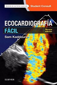 Ecocardiografia facil + StudentConsult (3a ed.)