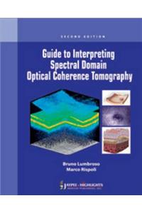 Guide to Interpreting Spectral Domain Optical Coherence Tomography