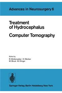 Treatment of Hydrocephalus Computer Tomography