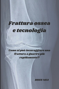 Frattura ossea e tecnologia