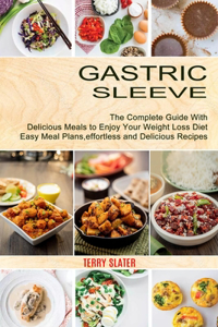 Gastric Sleeve