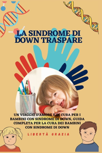 La sindrome di Down traspare