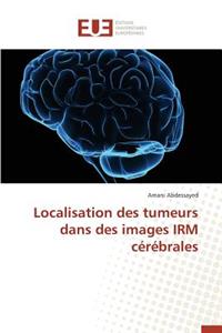 Localisation Des Tumeurs Dans Des Images Irm Cérébrales