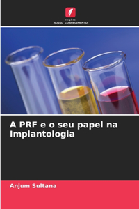 A PRF e o seu papel na Implantologia