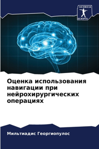 Оценка использования навигации при нейро