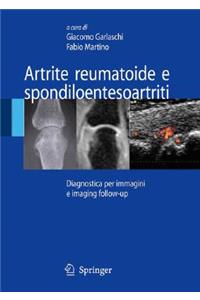 Artrite Reumatoide E Spondiloentesoartriti